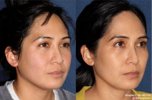 Customized maintenance treatment