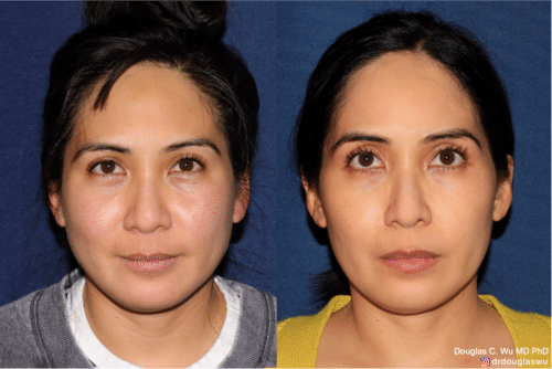 Customized maintenance treatment