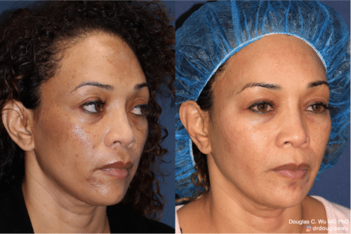 Customized maintenance treatment