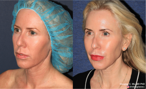 Customized maintenance treatment