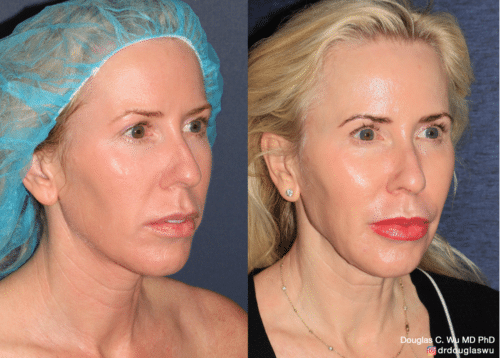 Customized maintenance treatment