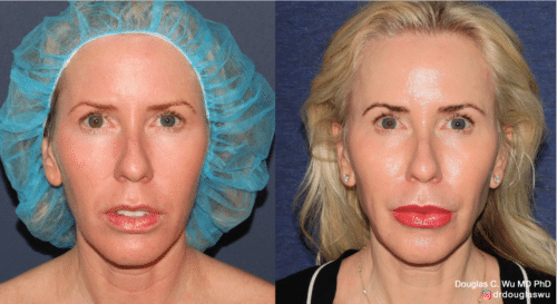 Customized maintenance treatment