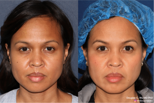 Customized maintenance treatment