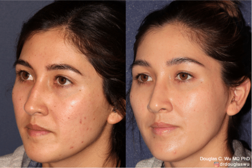 Customized maintenance treatment 10 years later