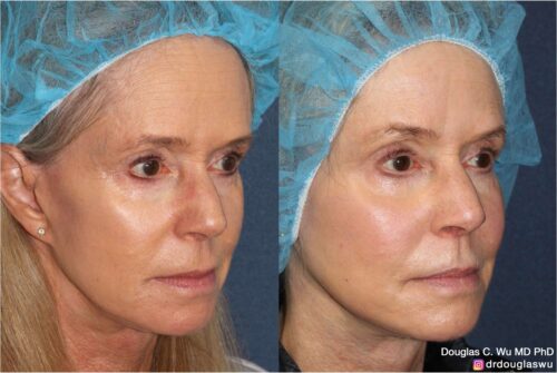 Customized maintenance treatment plan (10 years later)