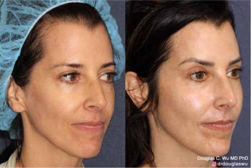 Customized maintenance treatment plan (5 years later)