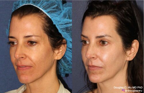 Customized maintenance treatment plan (5 years later)