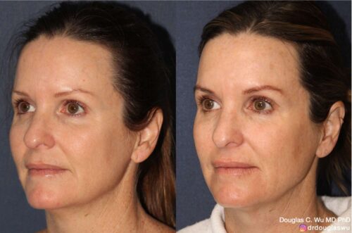 Customized maintenance treatment plan (5 years later)