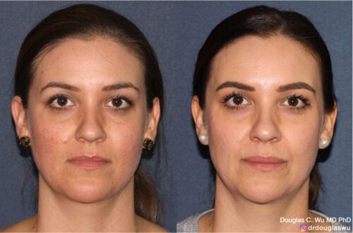 Customized maintenance treatment plan (10 years later)